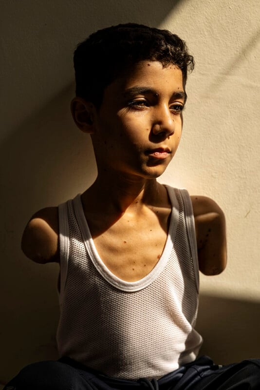 A boy with short curly hair and no arms sits against a beige wall, wearing a white tank top, looking thoughtfully into the distance as sunlight partially illuminates his face and chest.