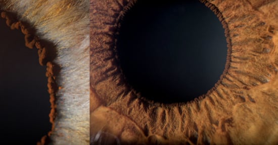 eye